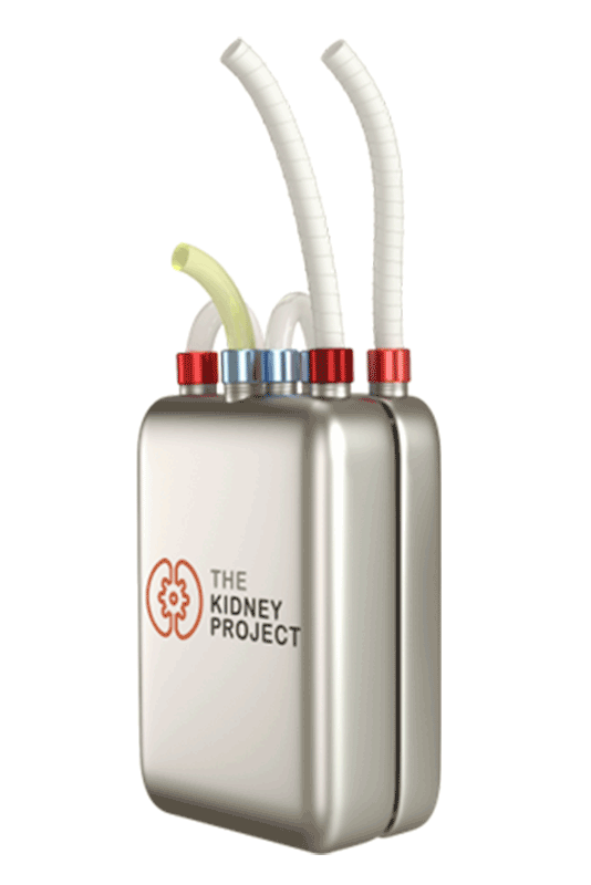 A 3D schematic of an artificial kidney. A rectangular box has four tubes ejecting from it that perform important kidney functions.