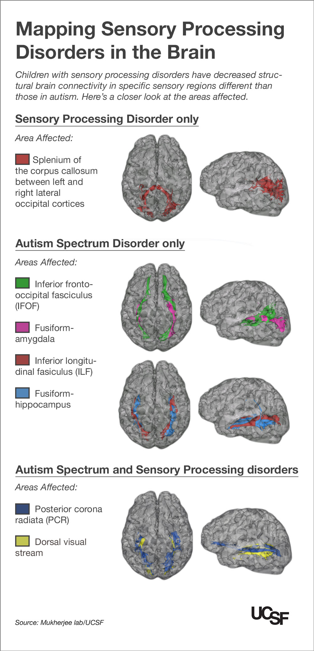 Kids with Autism, Sensory Processing Disorders Show Brain ...