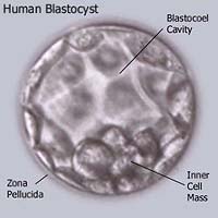 Human blastocyst containing stem cells