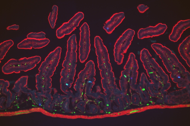 Enterochromaffin cells (blue) in finger-like projections within the gut villi (outlined in red) detect noxious chemicals.