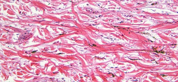 A microscopic image of skin cells.