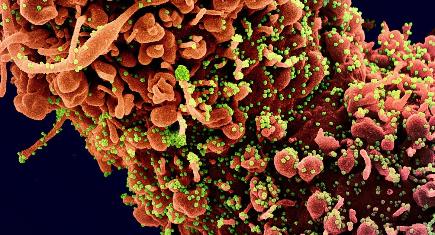 Novel Coronavirus SARS-CoV-2 colorized scanning electron micrograph
