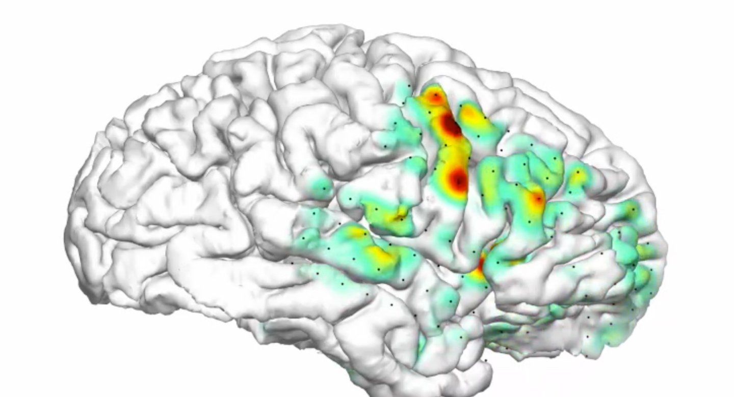 animations shows a 3-D heat map of a where a seizure is occurring in the brain