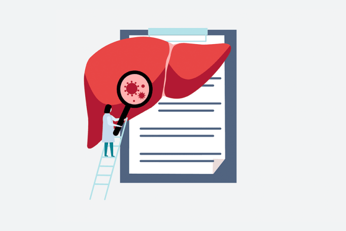 An illustration of a scientist observing disease on a liver with a large magnifying glass. In the background is a clipboard to show patient data.