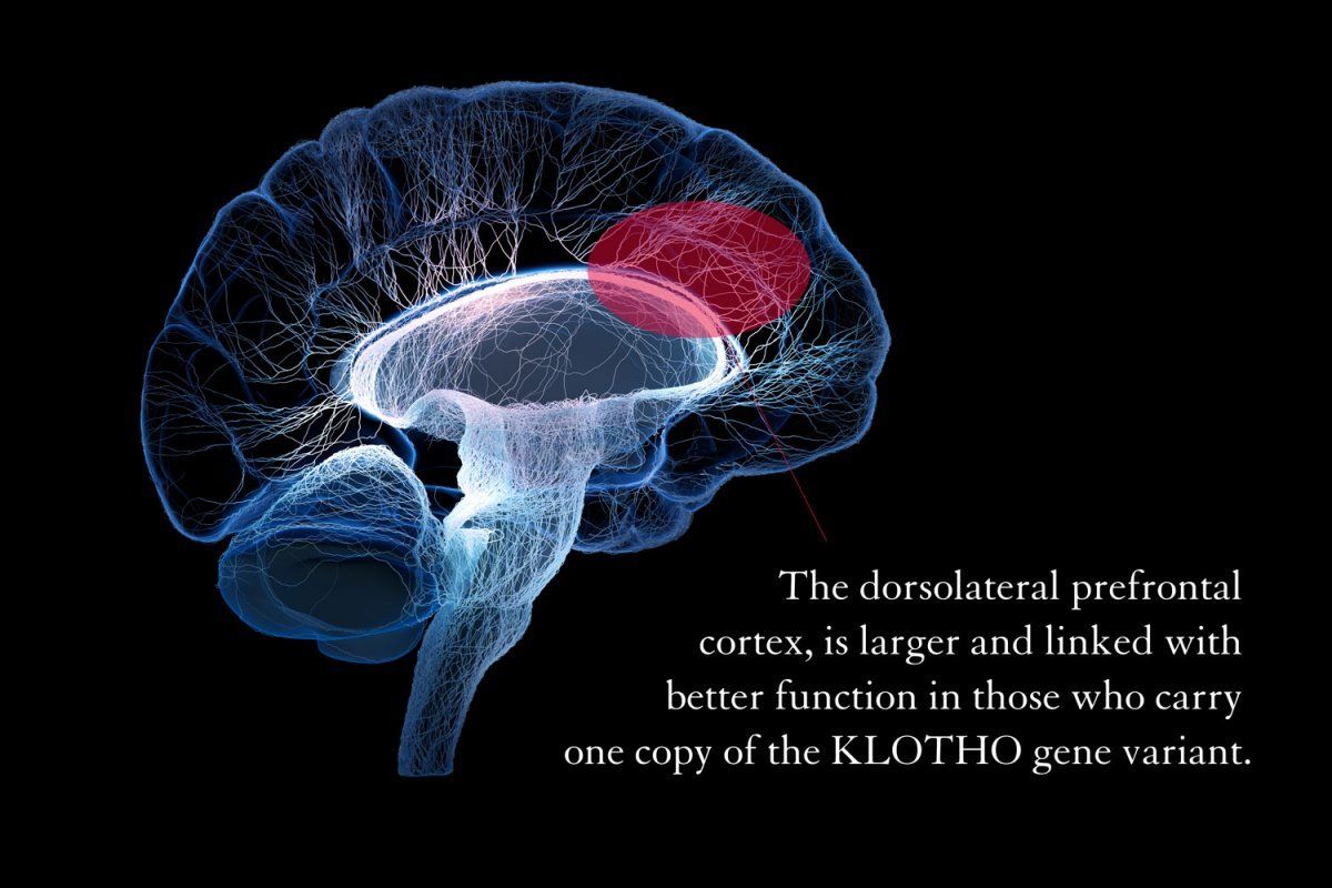 Graphic rendering of the brain, below is the following text "The dorsolateral prefrontal cortex is larger and linked with better function in those who carry one copy of the KLOTHO gene variant."