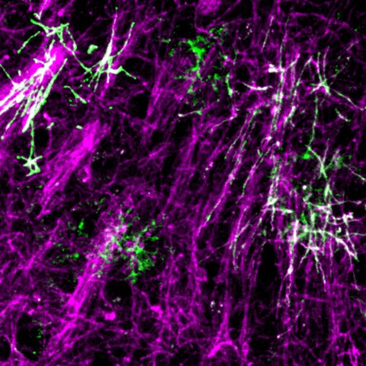 Microscopic image of myelin