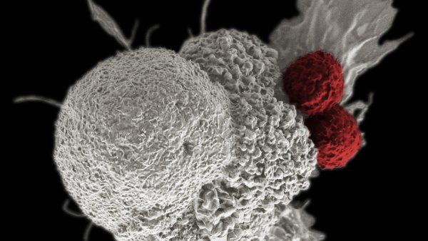 microscopic image of cancer cell attacked by two cytotoxic T cells