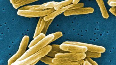 Tuberculosis_Dr.RayButler_CDC_0.jpg