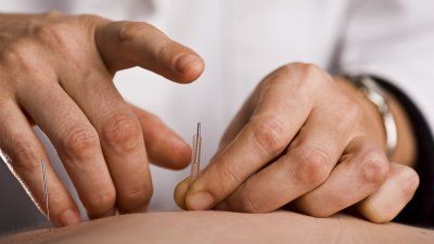 doctor-acupuncture-hands.jpg