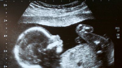 ultrasound_image.jpg