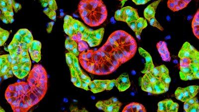salivary_stem_cells.jpg