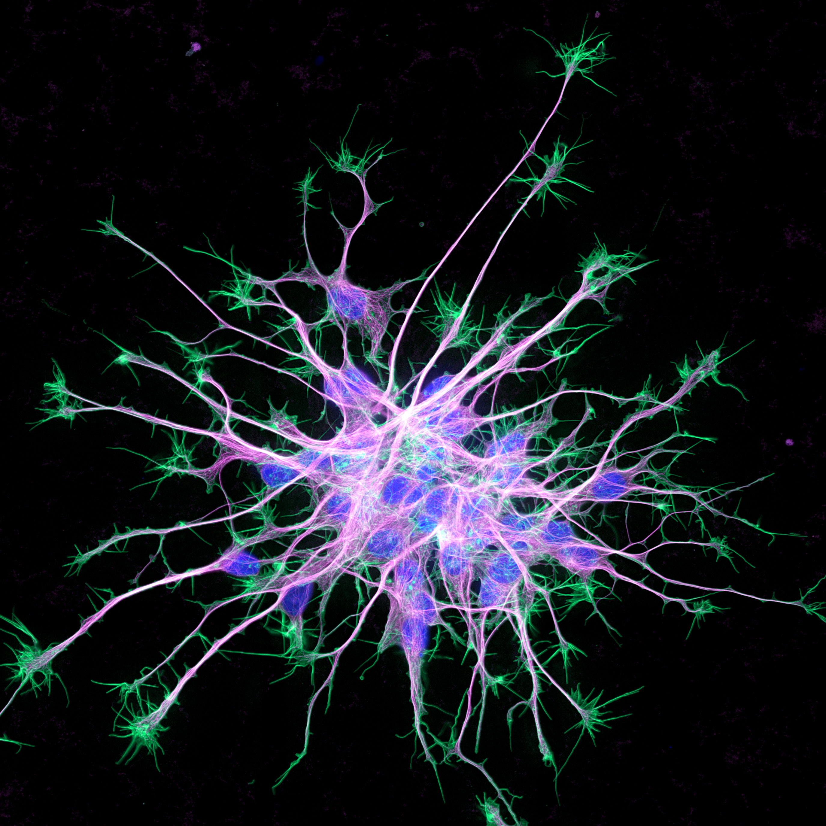 A Glimpse Inside Young Neurons Wins 2019 UCSF Sci