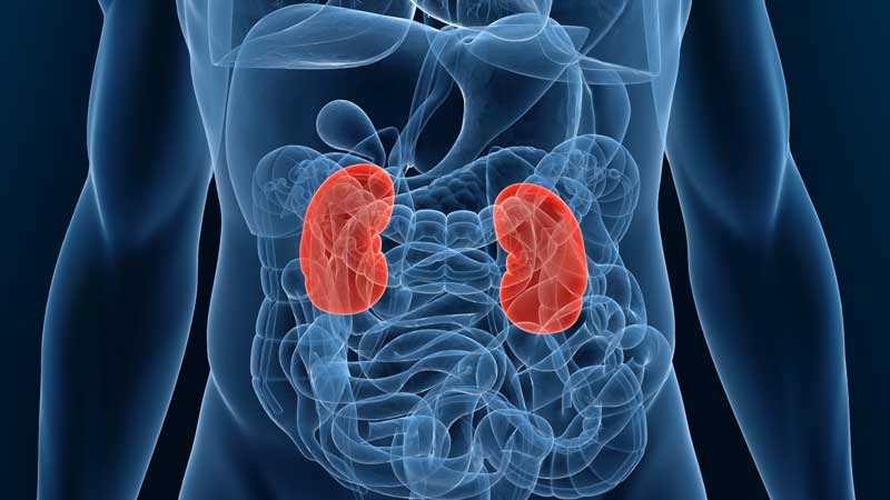 Chronic Kidney Disease Patients Face Continual, Significant Gaps in Care |  UC San Francisco