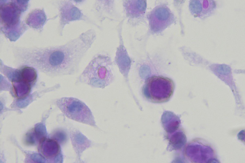 Microscopic image of Coccidioides immitis interacting with macrophages 