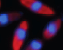 Microscopic image of a protein that normally cuts phage DNA, dyed blue surrounded by restriction enzyme dyed red.