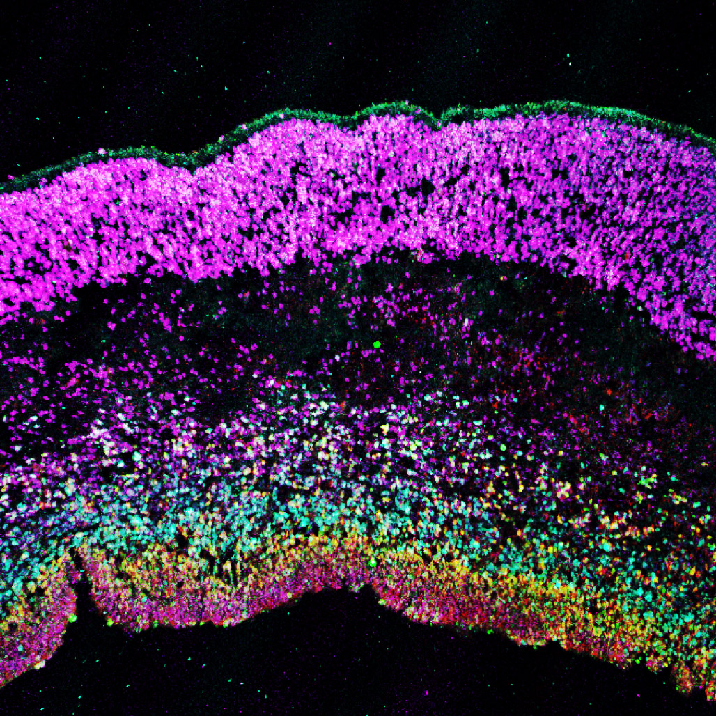 microscopic image of brain development at 13 weeks