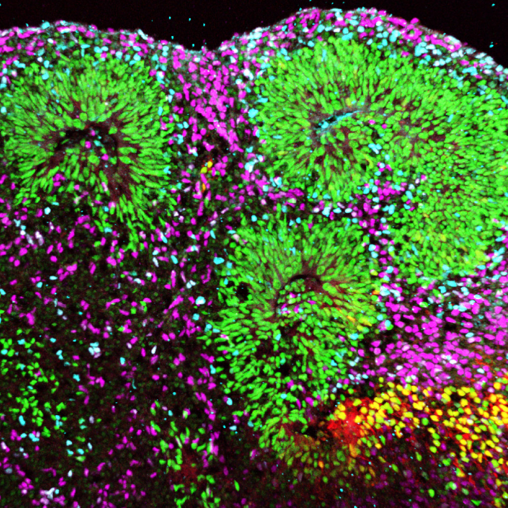 microscopic image of brain organoid at 5 weeks