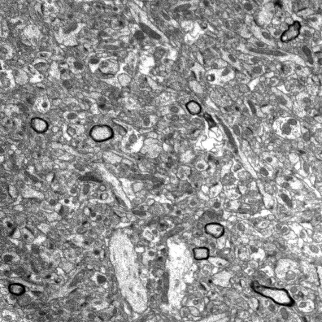 EM of myelinated axons in conditioned mouse