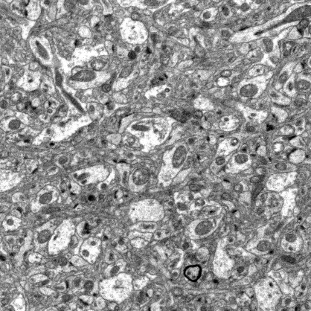 EM of myelinated axons in control mouse