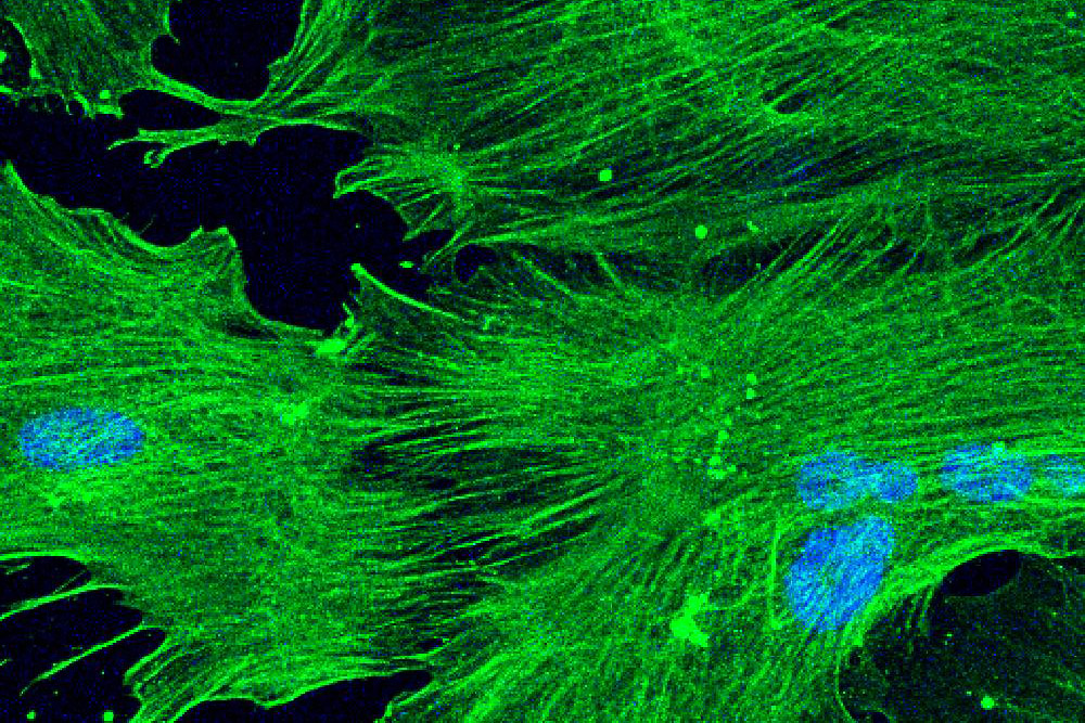 microscopic image of mesenchymal stromal cells