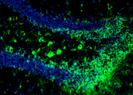 Concentration of tau tangles (in green), a phenomenon associated with Alzheimers, in the brains of mice without FNSS genes