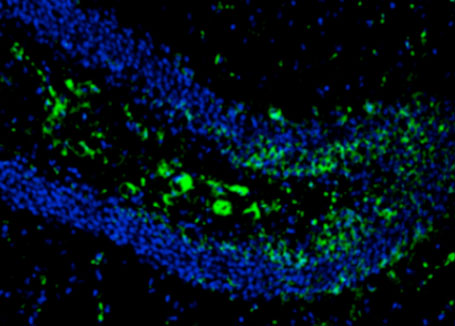 Concentration of tau tangles (in green), a phenomenon associated with Alzheimers, in the brains of mice with FNSS genes