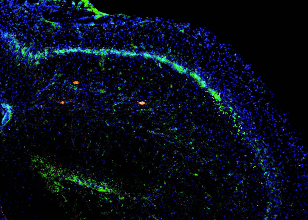 Florescence image of the newly discovered circuit in action, showing long-distance neurons from the prefrontal cortex (green) giving direct input to specialized neurons in the hippocampus (red).