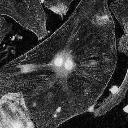 A black and white image of two nuclei in a senescent cell