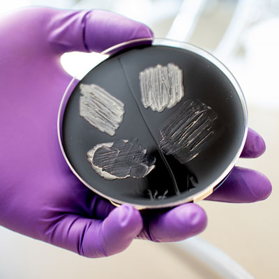 A hand wearing a purple latex glove holds a petri dish with a black charcoal exract layer and smears of cells on top.