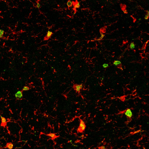 A microcopy showing microglia (red) in aged mice. Green and yellow areas in the microglia mark inflammation, which indicate aging.