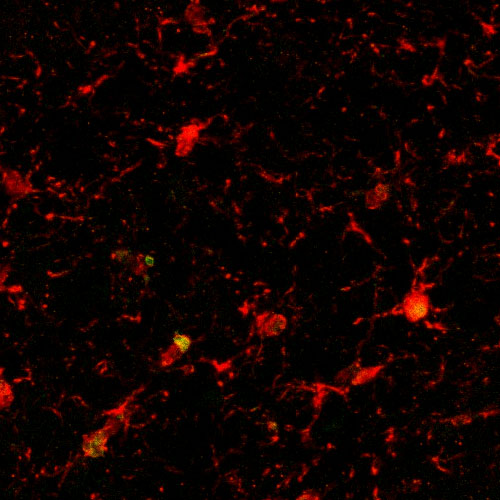 A microcopy showing microglia (red) in aged mice.