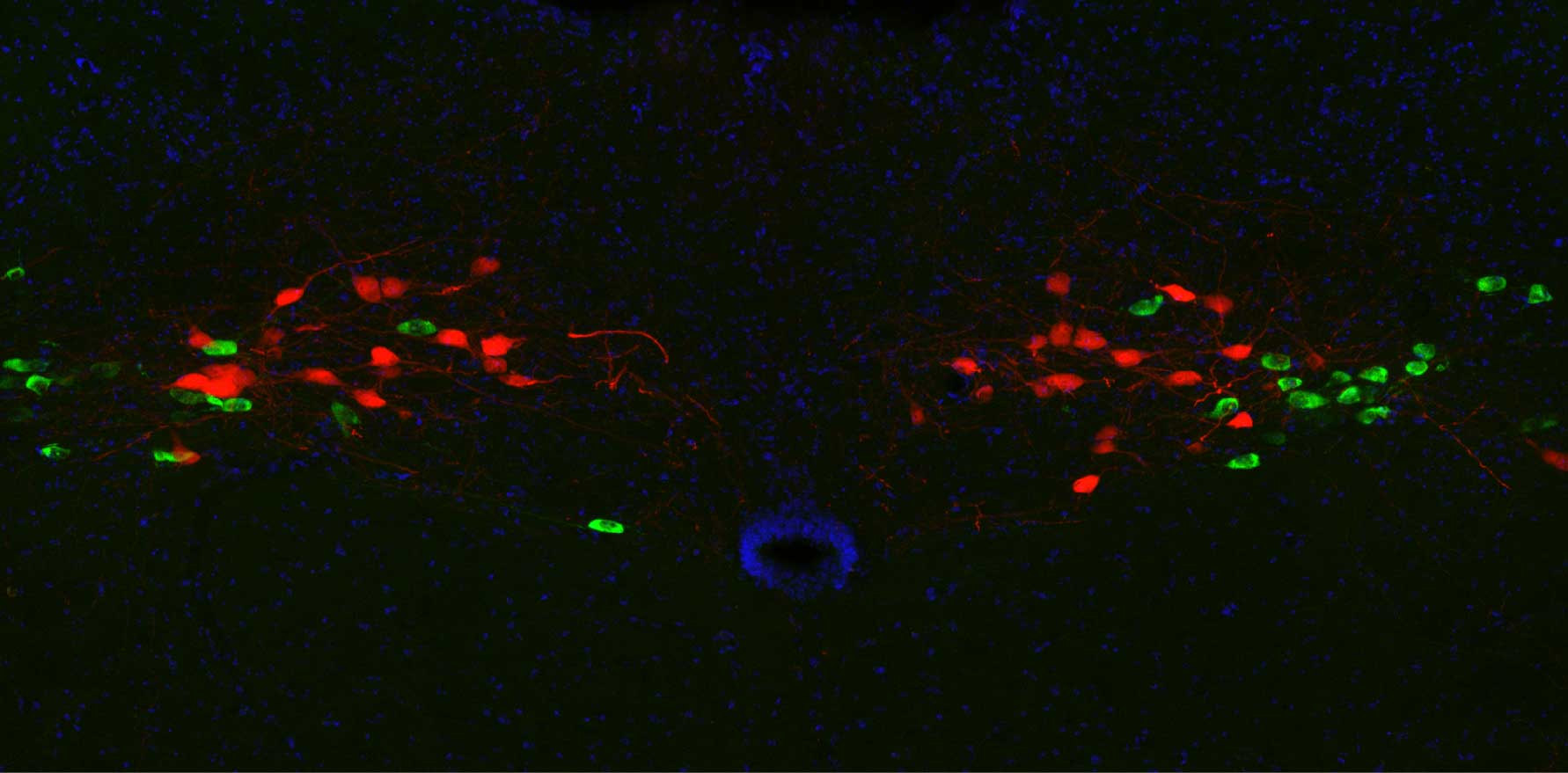 A brain scan of PRLH neurons (green) respond to signals generated from tasting food, and slow down the pace of eating. CGC neurons (red) respond to signals from the GI tract and provide the feeling of being full. 