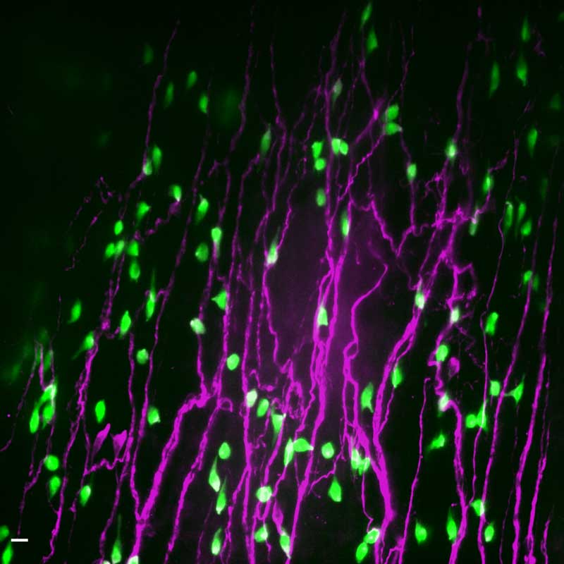 A microscopic image showing neuroendocrine cells near a neuron.