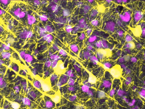 A microscopic image showing brain neurons and their elongated conenctions to one another. This image shows healthy connections between the neurons.