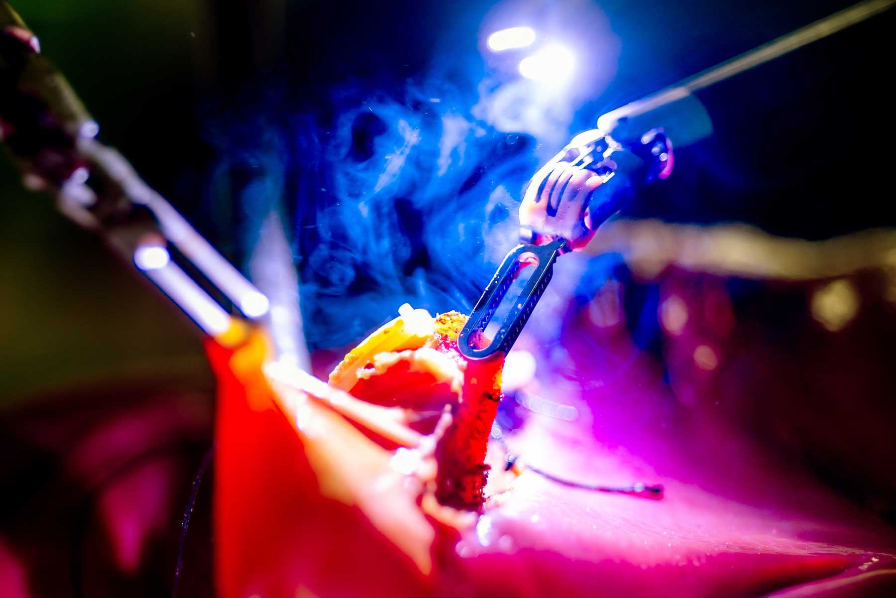A close-up view of robotic surgery performed on pig organs provided by a local butcher shop.
