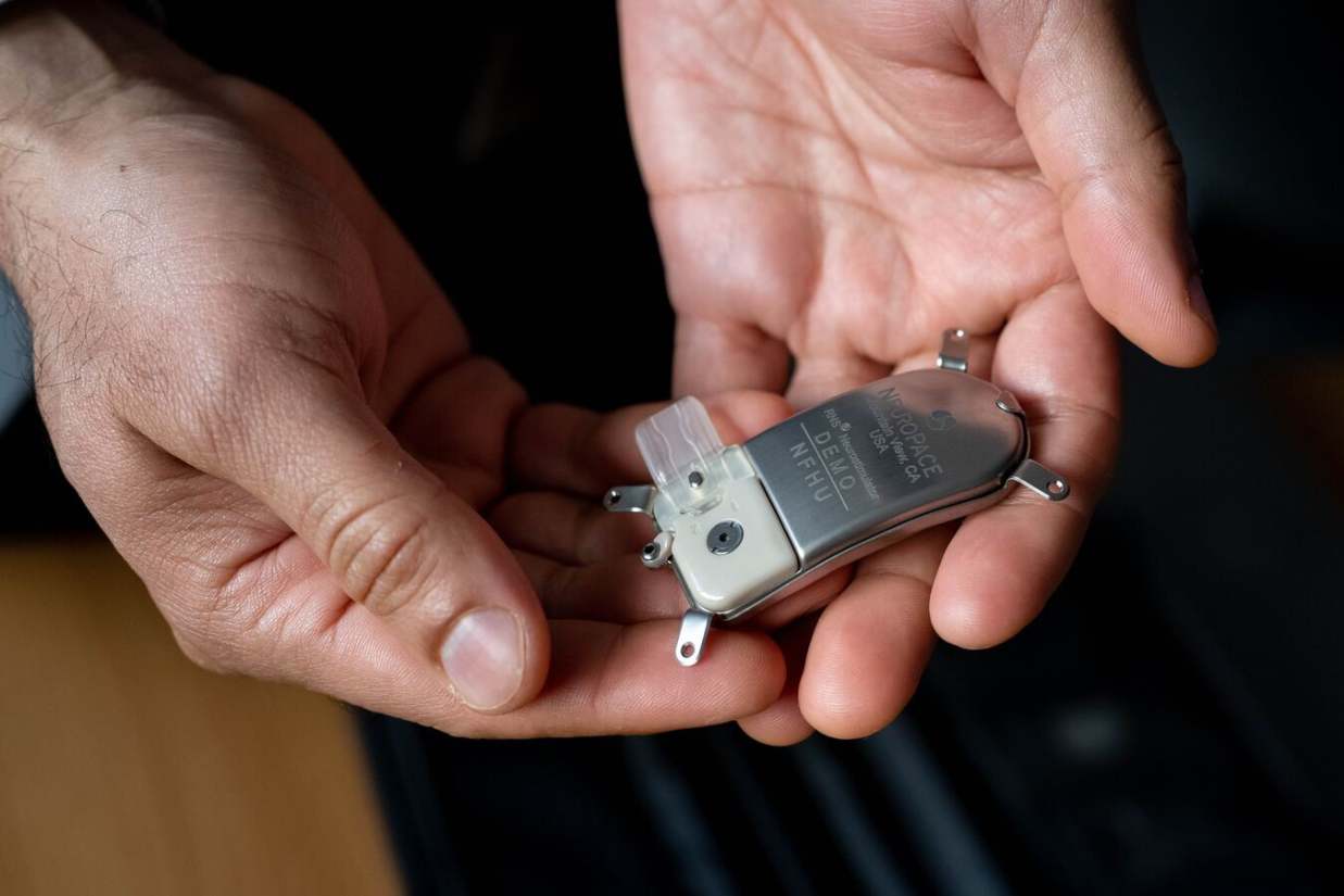 RNS neurostimulator that attaches to lead wire.