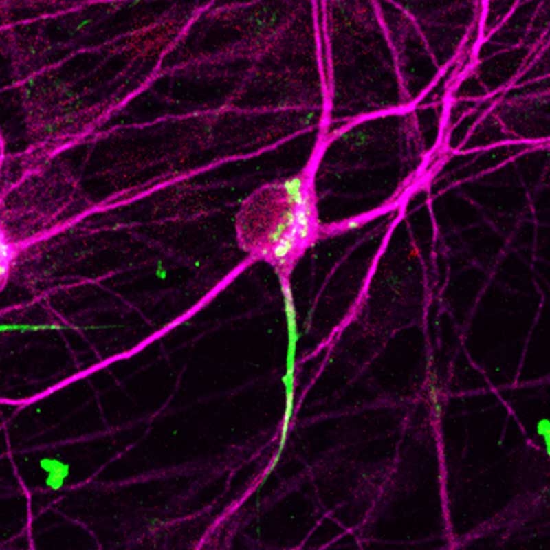 A microscopic image showing a nerve cell with a shorter neural wire fixed by CRISPRa.