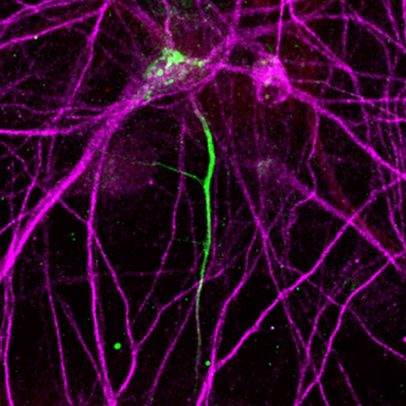 A microscopic image showing a nerve cell with a long neural wire.