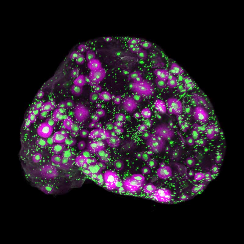 A microscopic image of a mouse ovary at 2 months, showing a large presence of eggs.