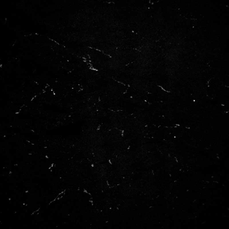 A microscopic image showing few sympathetic nerves in an ovary at 23 years of age.