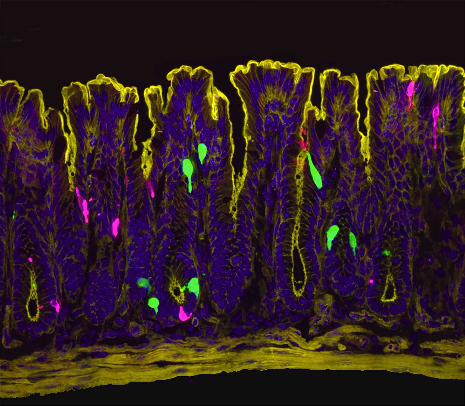 Microscopic zoomed in image of the colonic epithelium.