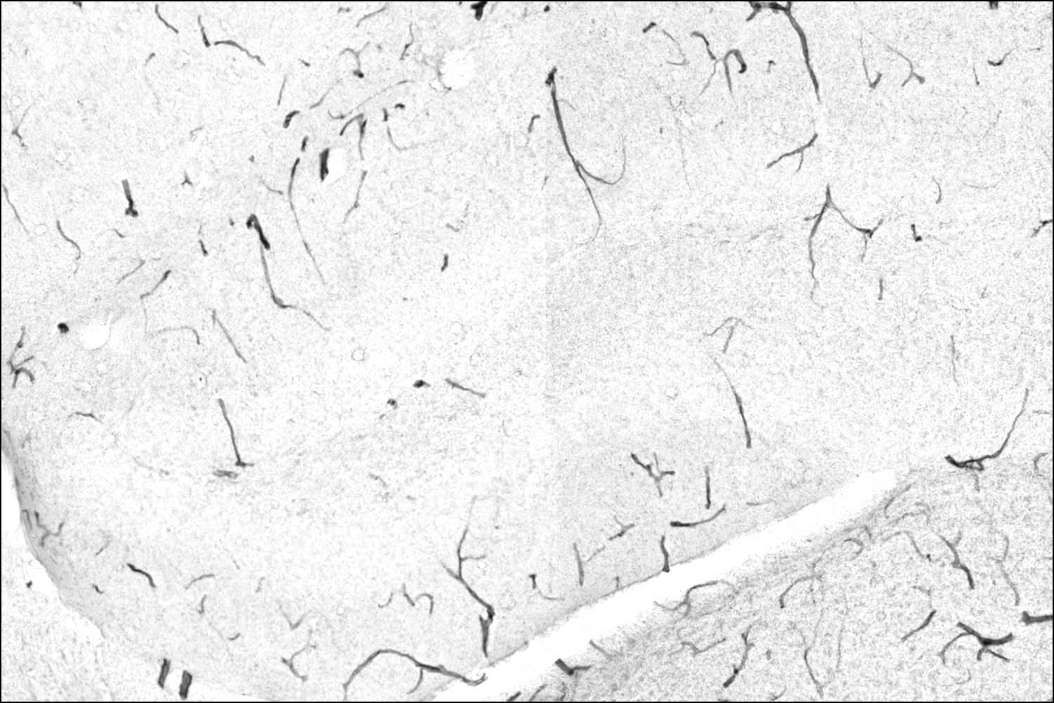 A microscopic image showing less amounts of TNAP protein in blood vessels, signaling to a healthier brain.