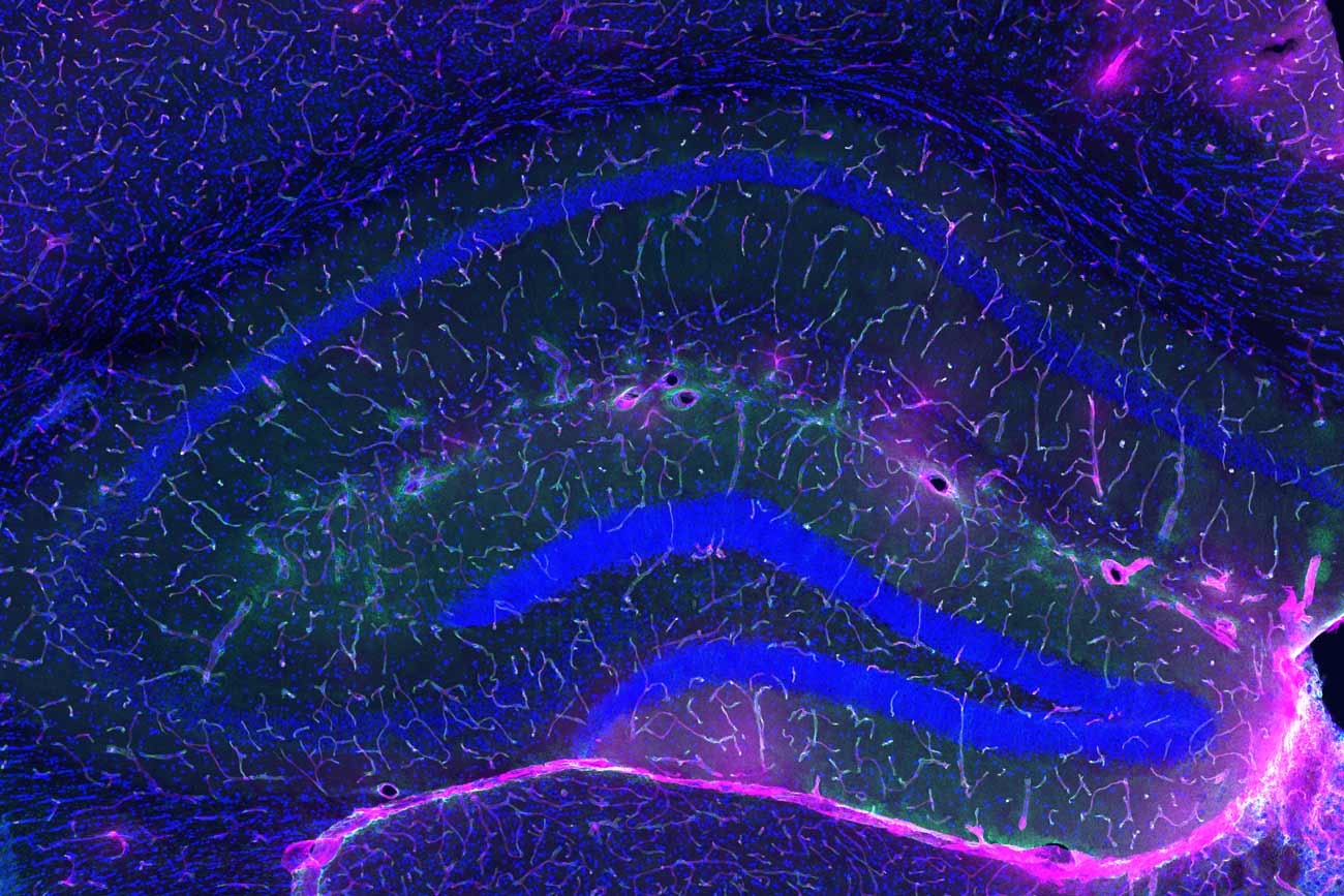 A microscopic image of an older brain depicting lower amounts of pink dye that are blocked by a blood-brain barrier treated with G P L D 1.