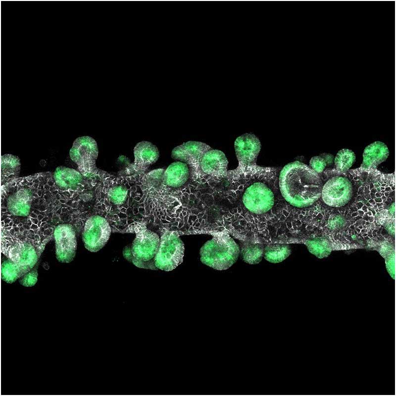 A fluorescent microscope image of a bioprinted intestinal organoid tube featuring green stem cell markers and budding structures against a black background.