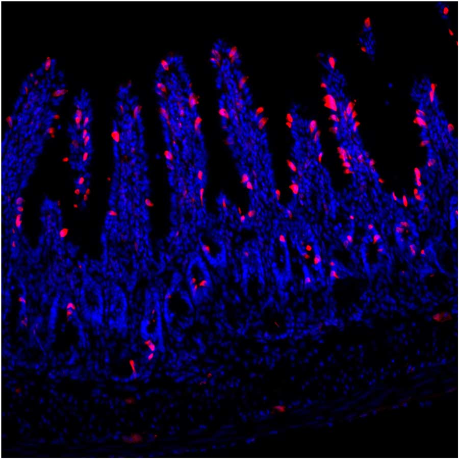 A microscopic image shows several blue, finger-like structures called villi against a black background, which are densely covered with numerous bright pinkish-red spots, which are specialized cells known as tuft cells.