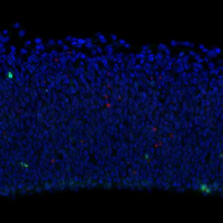 Microscopic image of healthy brain tissue showing a dense band of neurons against a black background, with occasional red and green spots.