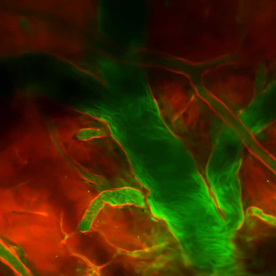 A microscopic image showing a segment of a mouse's brain with healthy blood flow.