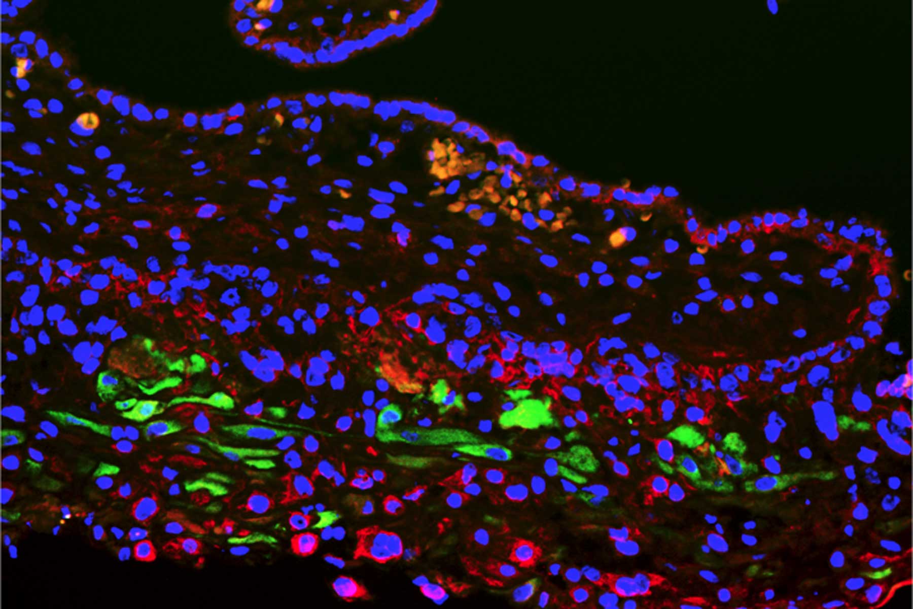A microscopic close-up of cells connecting mother and fetus, including a newly identified type linked to pregnancy outcomes.