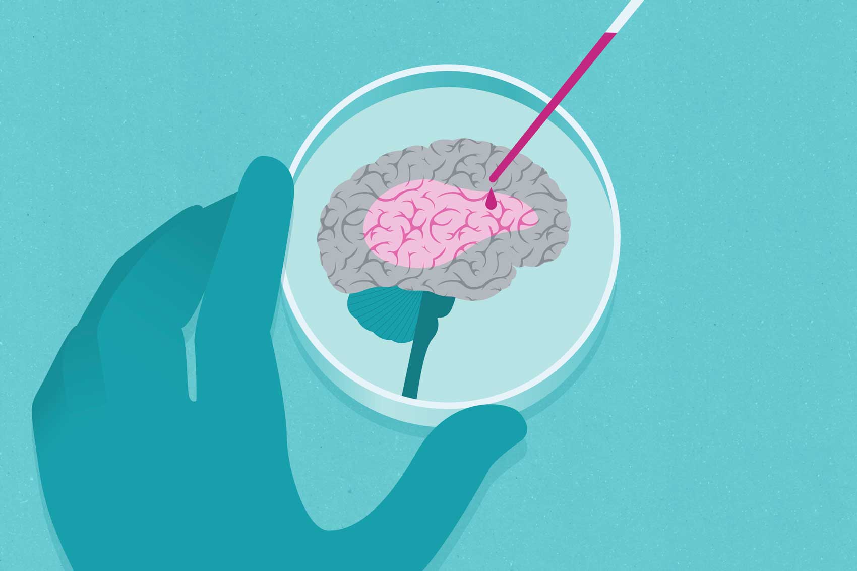 One Dose of Psilocybin Changes the Human Brain | UC San Francisco