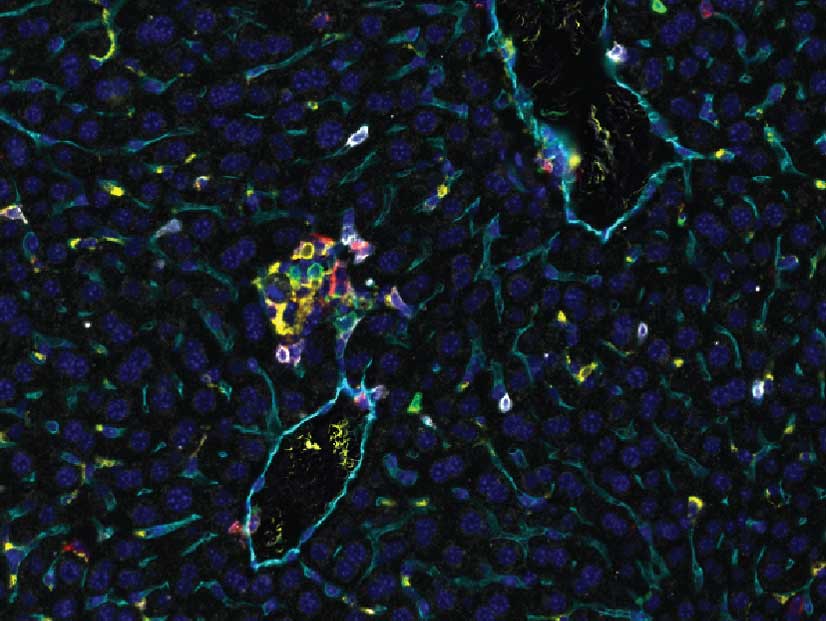 Fluorescent microscopy image showing tissue structure with many blue-stained nuclei and green outlines, with small scattered clusters of yellow and red signals.